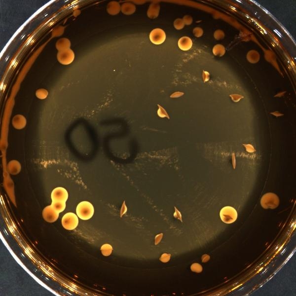 Aerob baktériumok száma (aerob mezofil baktériumok száma, aerob kolónia száma) - EUROLAB