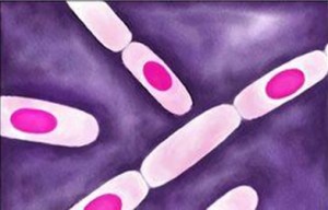 Bacillus-cereus-1