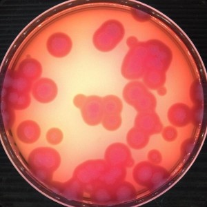 Bacillus-cereus-2